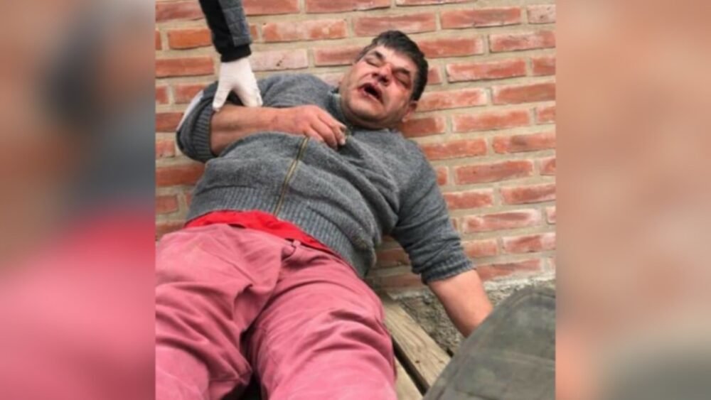 Brutal agresión policial contra un camionero de Madariaga: “Pensé lo peor”