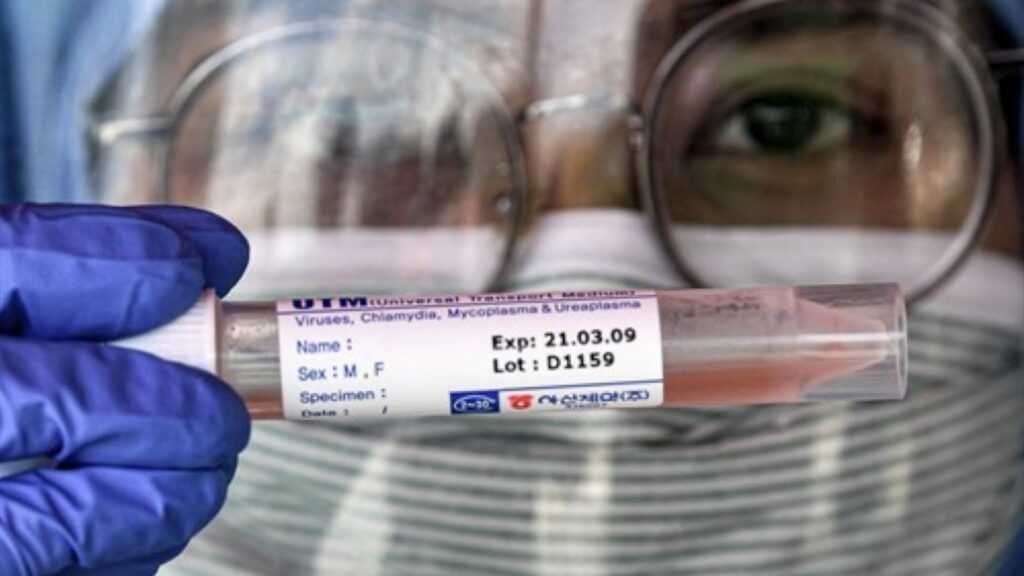 COVID 19 en Ayacucho: 20 resultados negativos y 1 recuperado