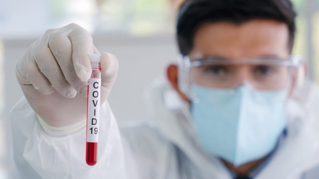 COVID 19 en Ayacucho: Un recuperado y en total son 2 activos