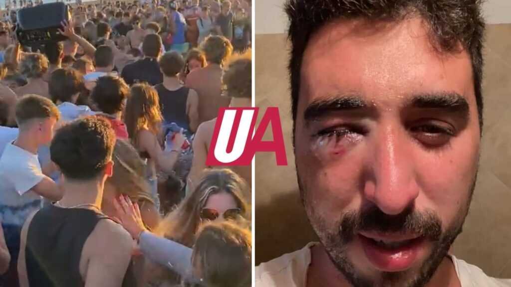 Descontrol total en Pinamar:  joven de 18 años resultó herida tras recibir un botellazo en medio de una batalla campal