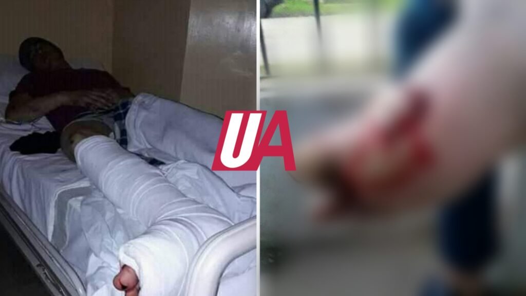 ¡Terrible!: Choco una moto y se dio a la fuga: Un joven gravemente herido