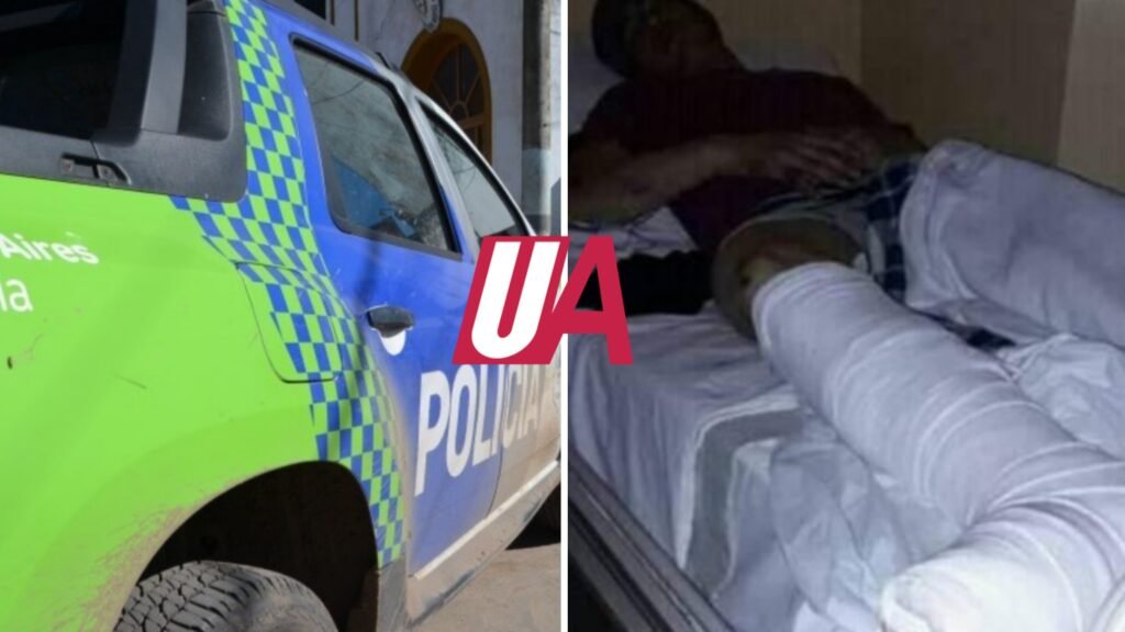 Habrían indentificado el vehículo que protagonizó el accidente que dejó un joven gravemente herido