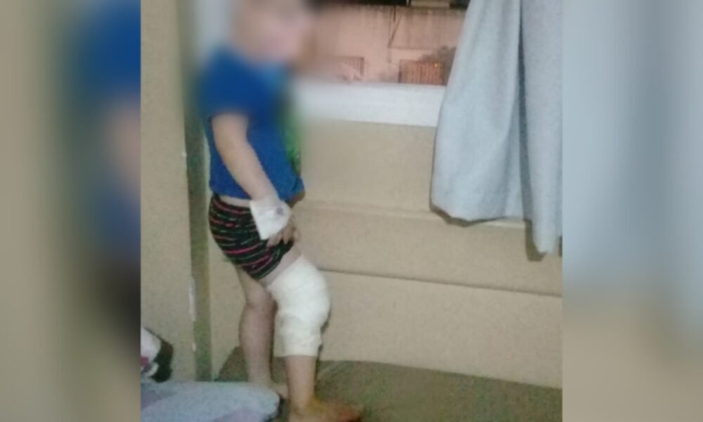 Denunció mala atención en el Hospital y su hijo tuvo que ser intervenido en otro centro de atención