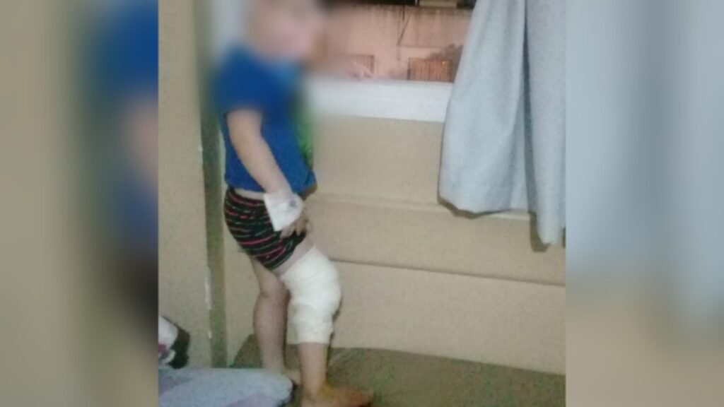 Denunció mala atención en el Hospital y su hijo tuvo que ser intervenido en otro centro de atención