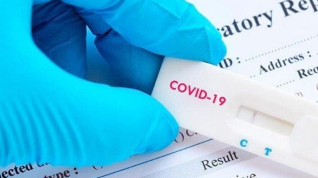 Cambiaron de lugar los testeos rápidos de coronavirus