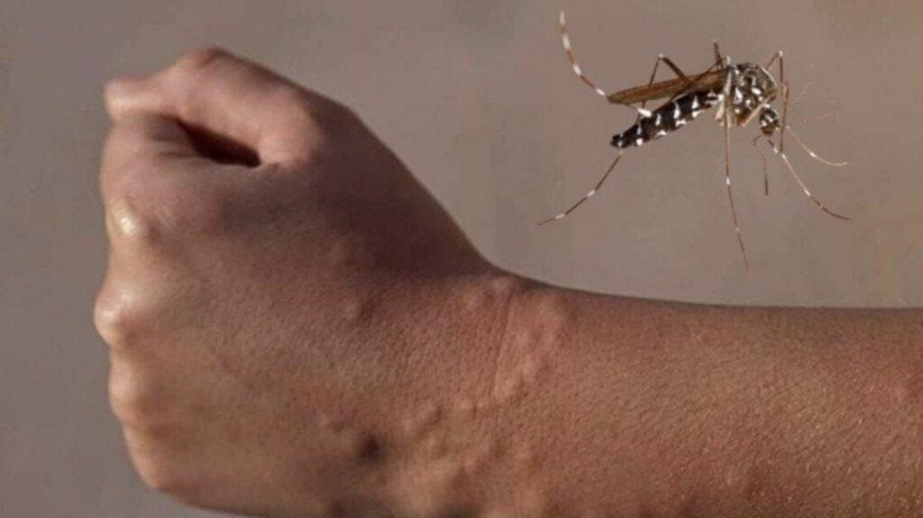 ¿Como prevenir el dengue?