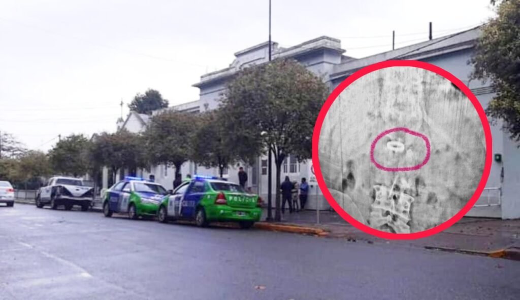 ¡INSÓLITO!: Robó un anillo y, cuando la Policía estaba por detenerlo, se lo tragó