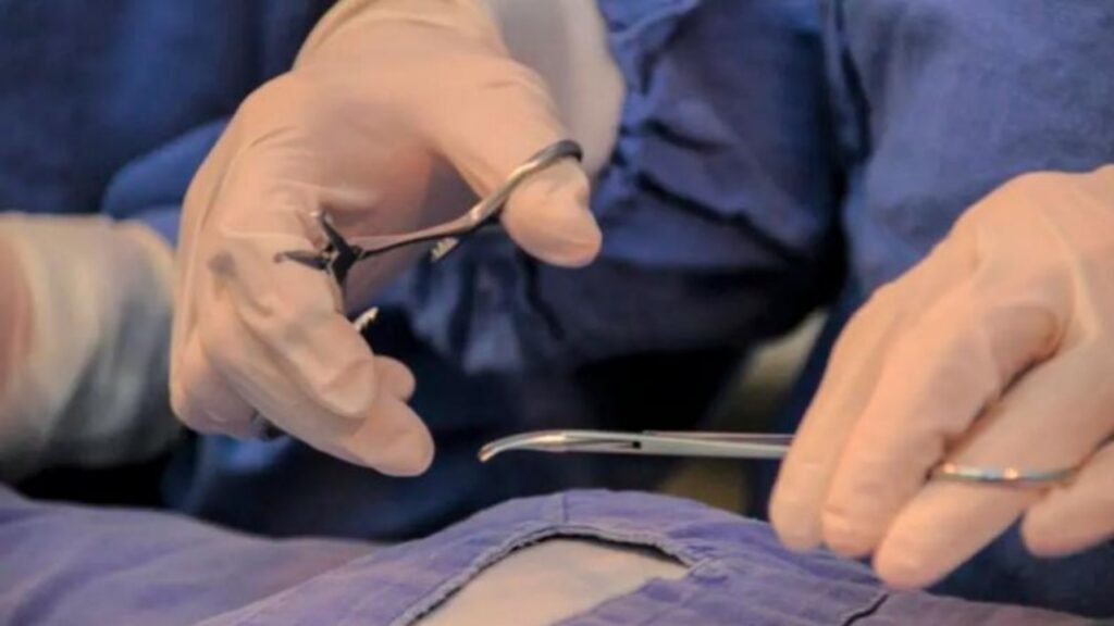 Esterilización en adolescentes: el Ministerio de Salud promueve la vasectomía y la ligadura de trompas desde los 16 años